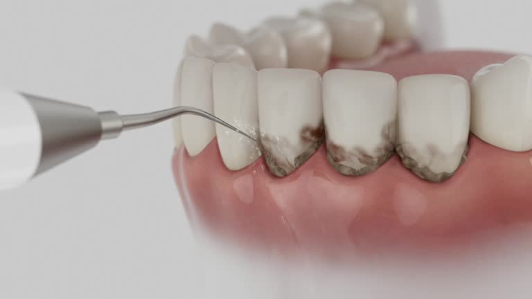 Trusted Emergency Dentist service in Plainwell, MI - Dentist Open Now